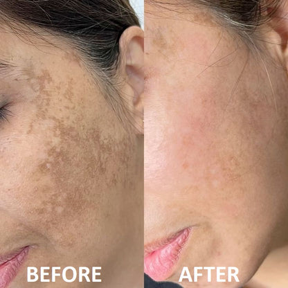 Professional 7-Color LED Face Mask - Clear Skin in 7 Days