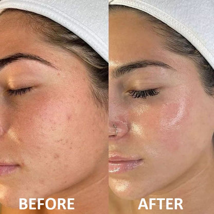 Professional 7-Color LED Face Mask - Clear Skin in 7 Days