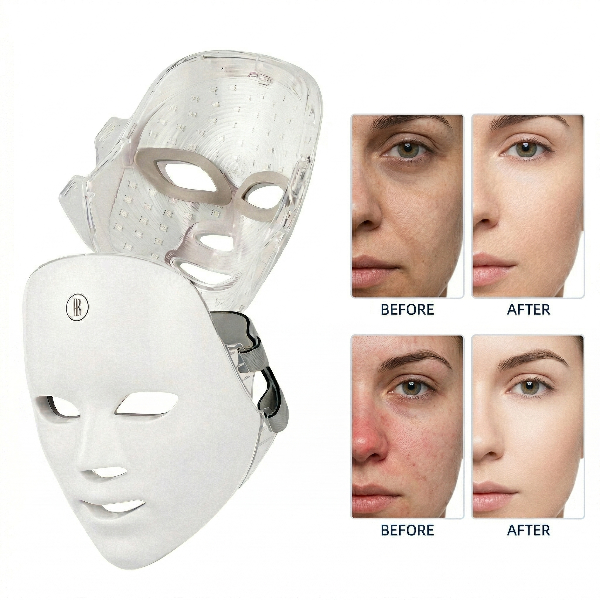Professional 7-Color LED Face Mask - Clear Skin in 7 Days
